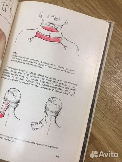 Книги по лечению ожогов, отморожений