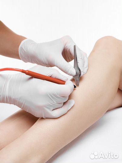 Курсы электроэпиляции в Чебоксарах