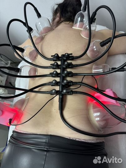 Вакуумный массаж