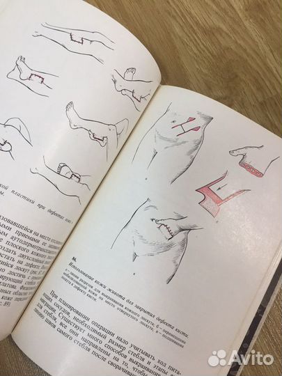 Книги по лечению ожогов, отморожений