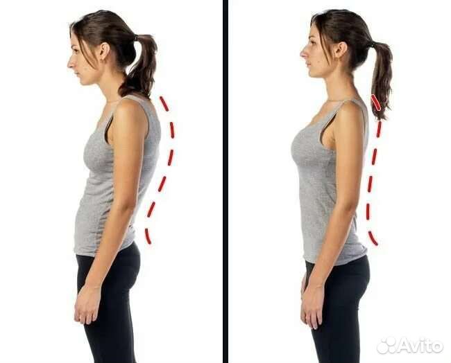 Коррекция осанки, массаж