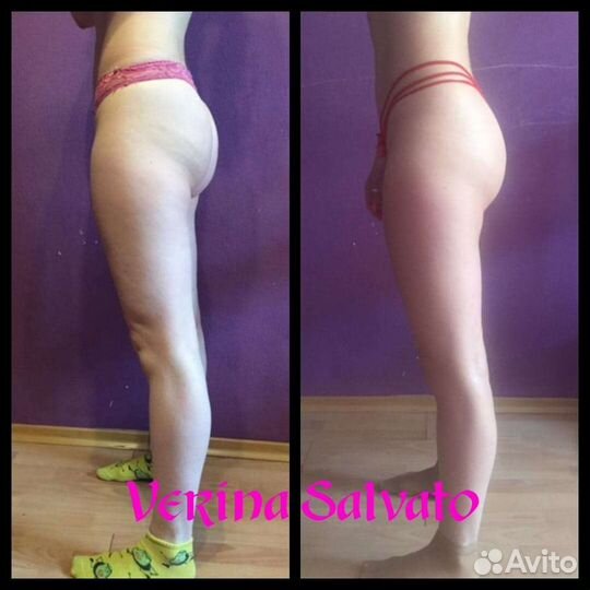 Антицеллюлитный массаж