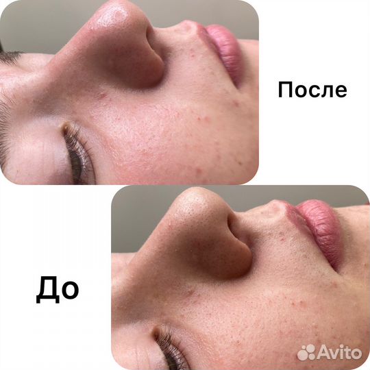 Услуги косметолога и перманентный макияж