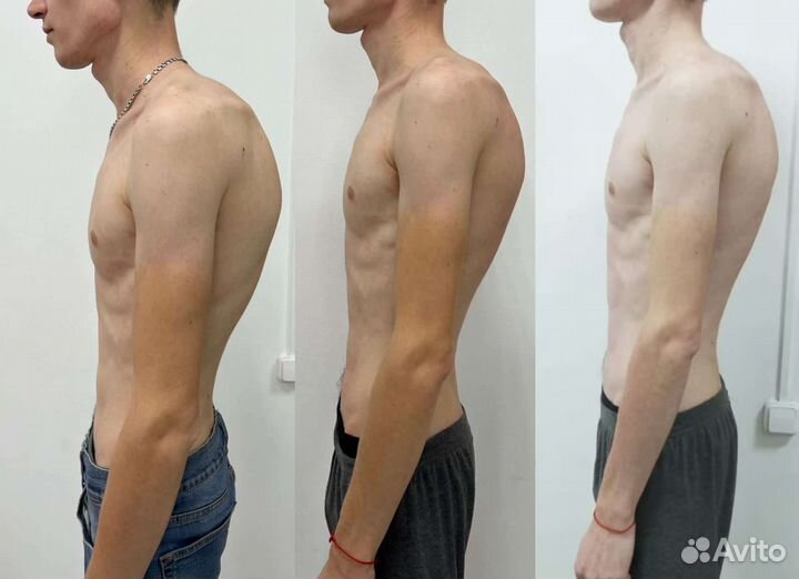 Услуги костоправа