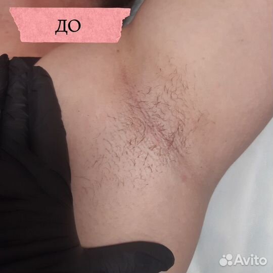 Модель на депиляцию