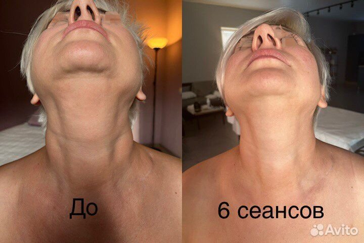 Миофасциальный массаж лица, шеи, головы