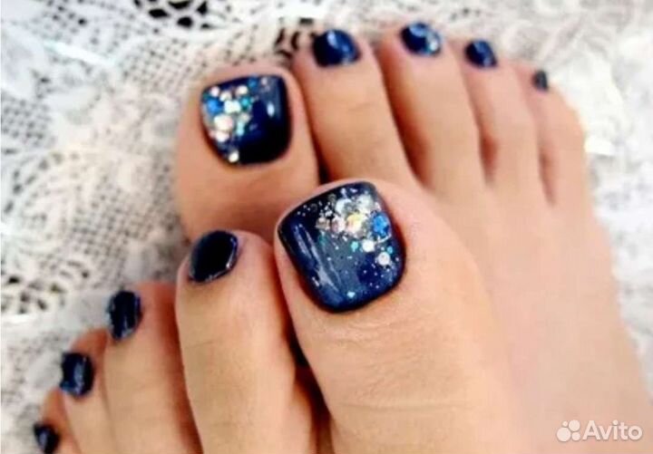 Педикюр Титановая нить Вросший ноготь Онихолизис