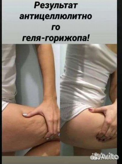 Антицеллюлитный гель