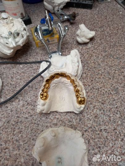 Работа зубной техник