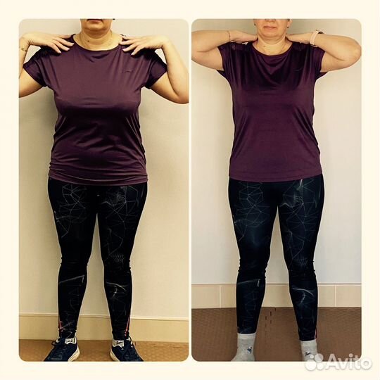 Карамельная липосакция.Аппаратный массаж