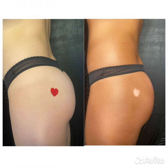 Моментальный загар