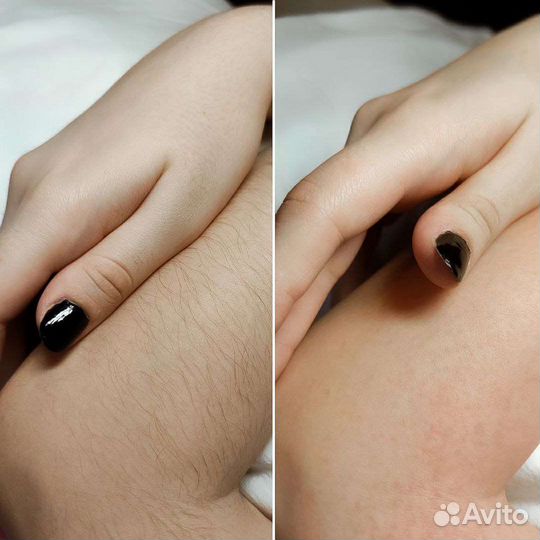 Шугаринг депиляция воск Автово Кировский завод