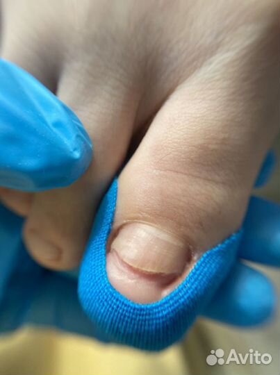 Подолог самара