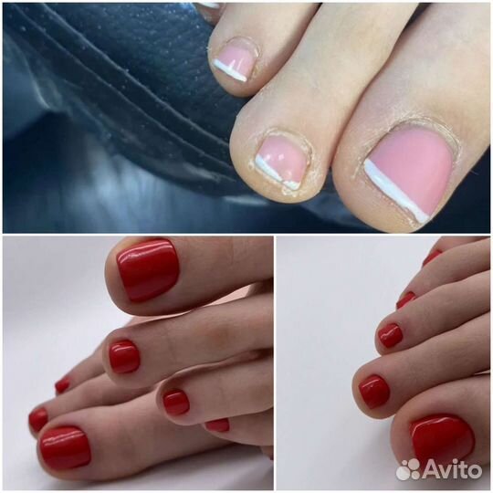 Педикюр на дому