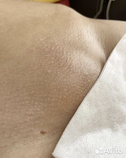 Шугаринг,воск, эпиляция