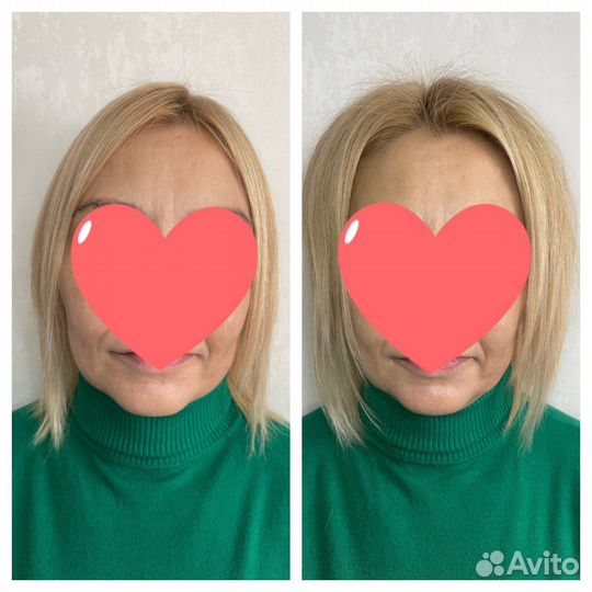 Прикорневой объем 