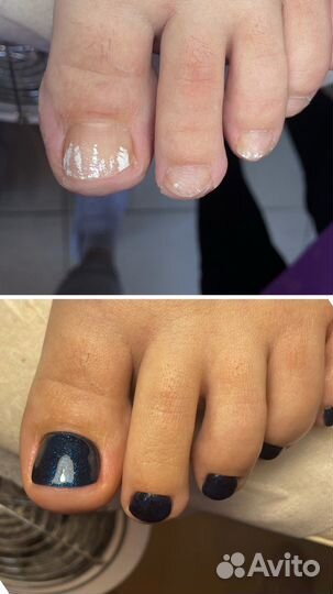 Педикюр на дому