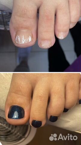 Педикюр на дому