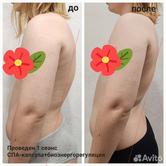 Массаж, коррекция осанки (сколиоз, кифоз, лордоз)