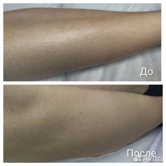 Шугаринг/Воск