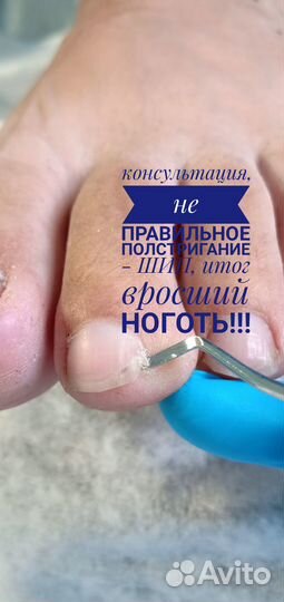 Подолог, педикюр