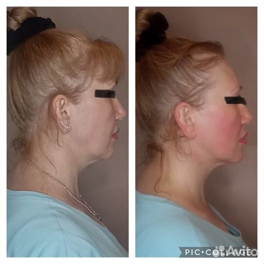 Массаж на дому