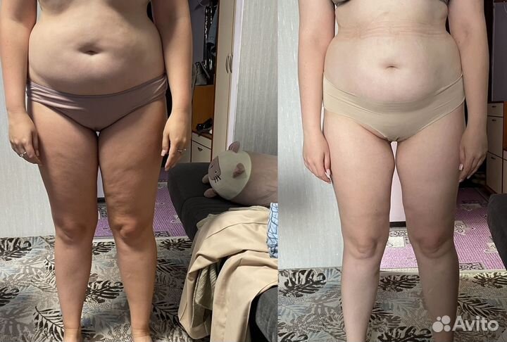 Антицеллюлитный массаж