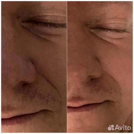 Массаж лица Парковый