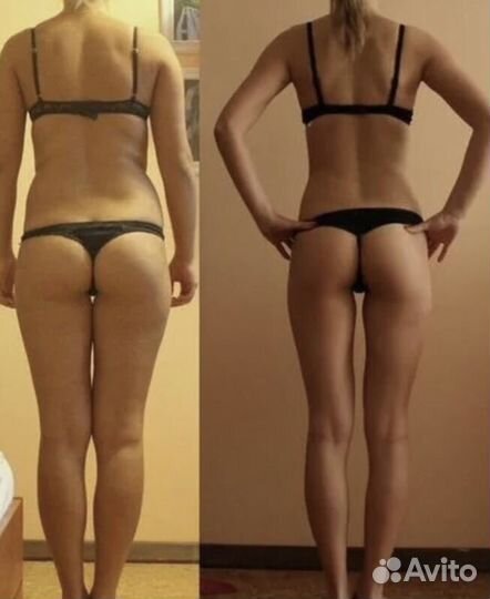 Ультразвуковая Кавитация