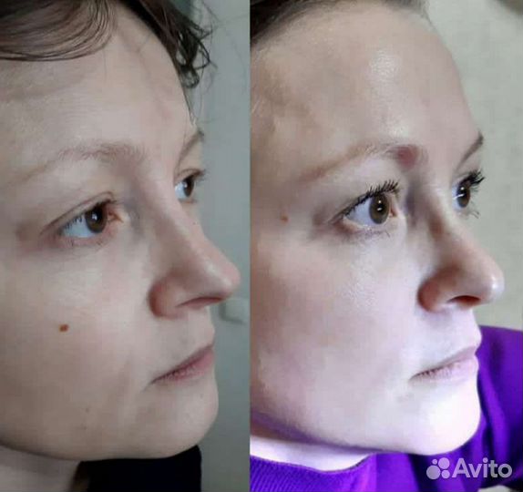 Скульптурный массаж лица