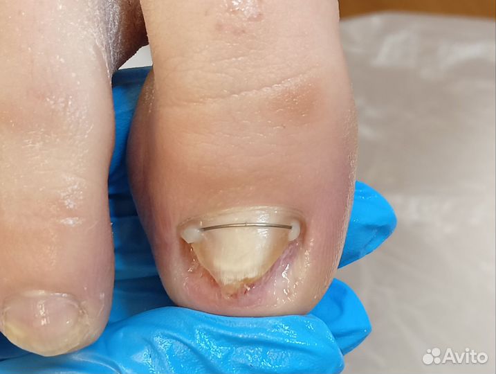 Услуги подолога