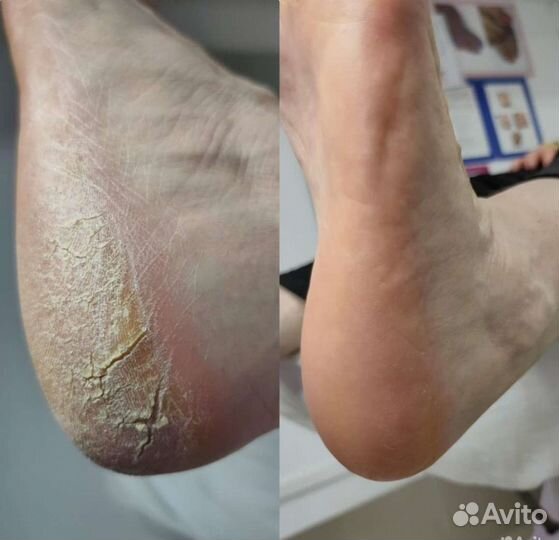 Маникюр/Педикюр/Гель-лак/Наращивание