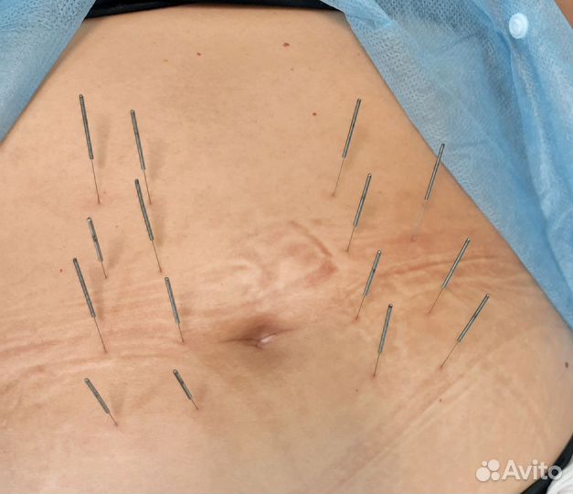 Лечение боли