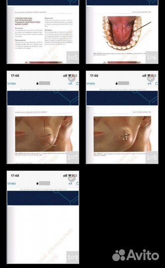 Наложение швов в стоматологии книга