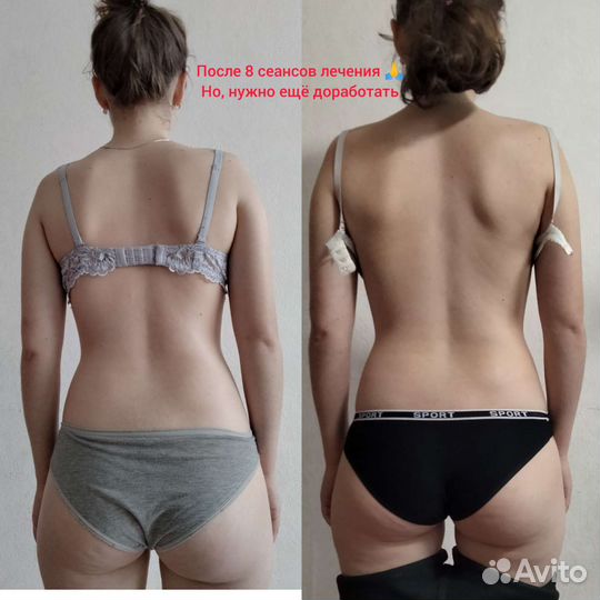 Миопрессура.Лечение мышц