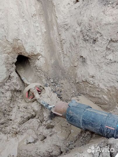 Г Н Б -прокол