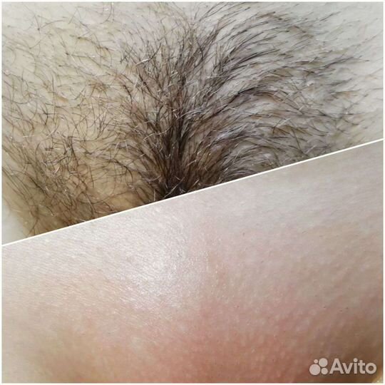 Шугаринг депиляция воск Автово Кировский завод