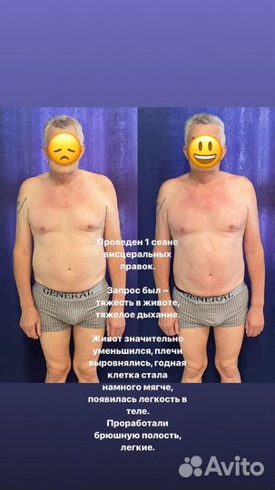 Висцеральные правки/Моделирующий массаж