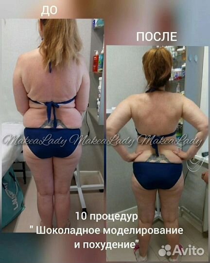SPA моделирование фигуры шоколад