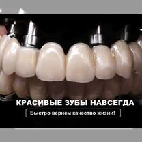 Имплантация зубов всё на 4. Оsstеm. Гарантия, Москва