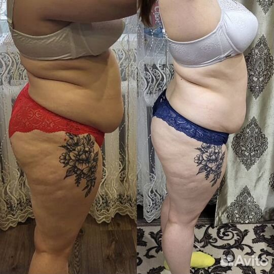 Аппаратная Коррекция фигуры