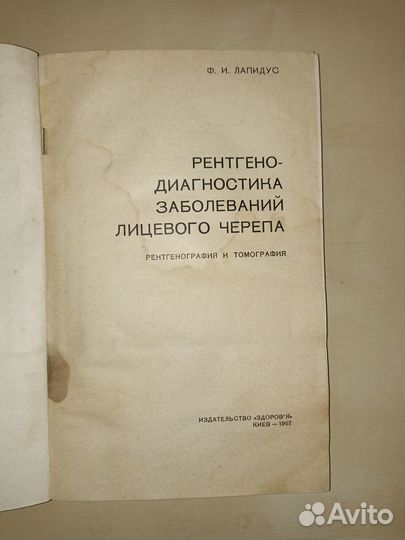 Рентгенодиагностика заболеваний лицевого черепа. 1