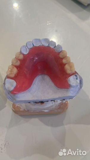 Съемные зубные протезы