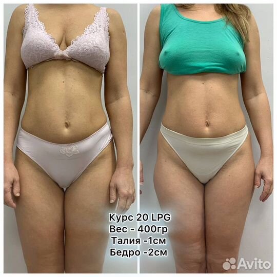 Массаж, для тех, кто хочет избавиться от 3 -12 см