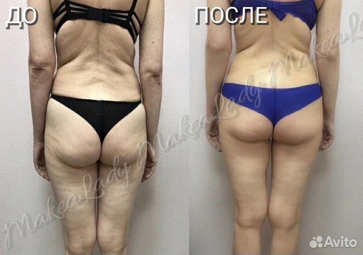 SPA моделирование фигуры шоколад