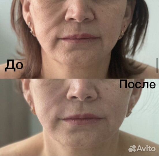 Массаж лица