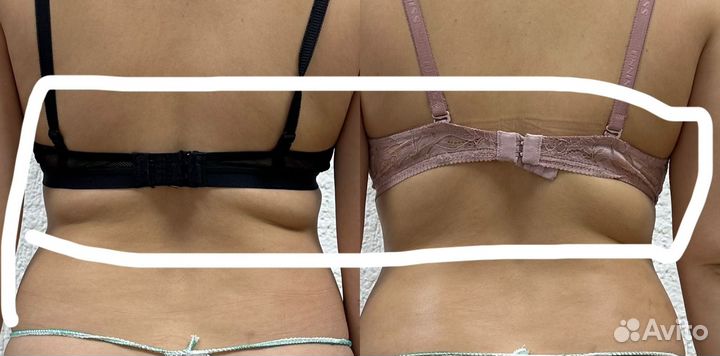 Аппаратный массаж. Кавитация, вакуумный массаж