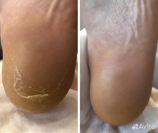 Маникюр.педикюр.Подолог