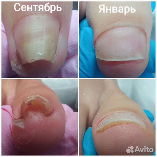 Аппаратный маникюр