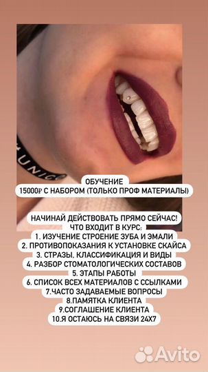 Установка скайса